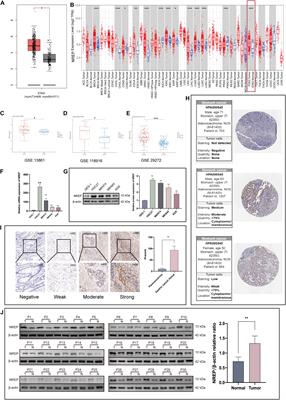 Overexpression of NREP Promotes Migration and Invasion in Gastric Cancer Through Facilitating Epithelial-Mesenchymal Transition